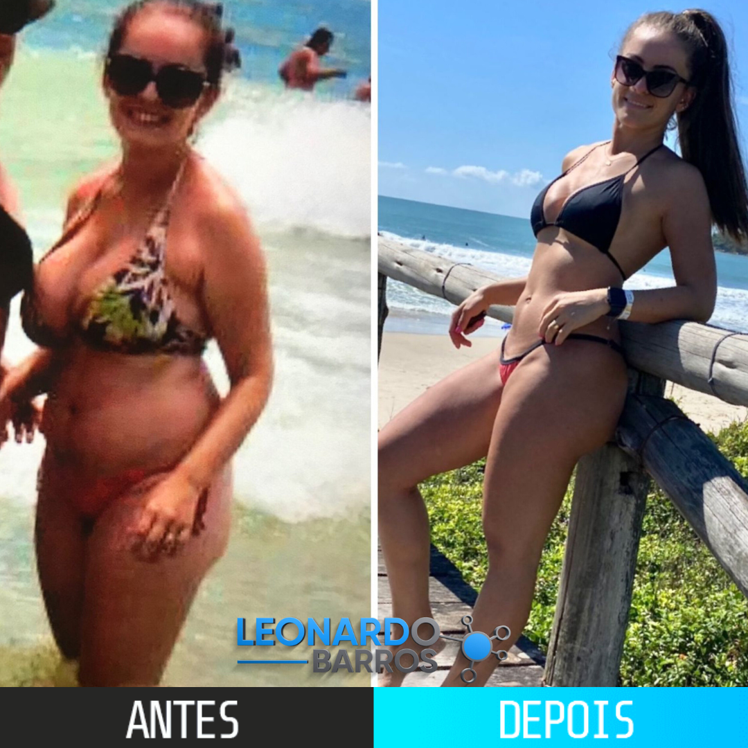 Antes e depois — ANGELA ROSSETO, 33 ANOS. Emagrecimento e Saúde..